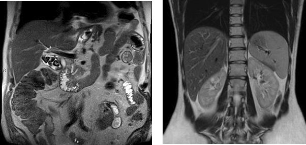 mrt-abdomen.jpg