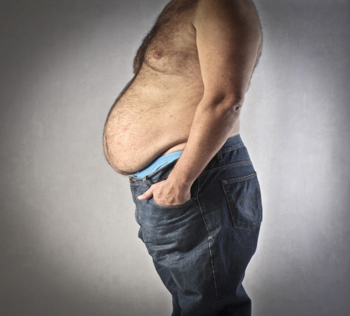 Абдоминопластика: как убрать обвисший живот с помощью медицины