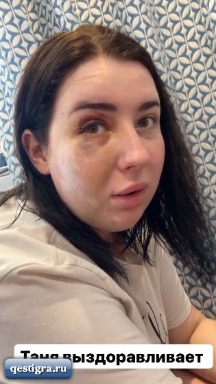 Из жизни Саши Черно за сегодня - Ребенок заболел, Тане получше