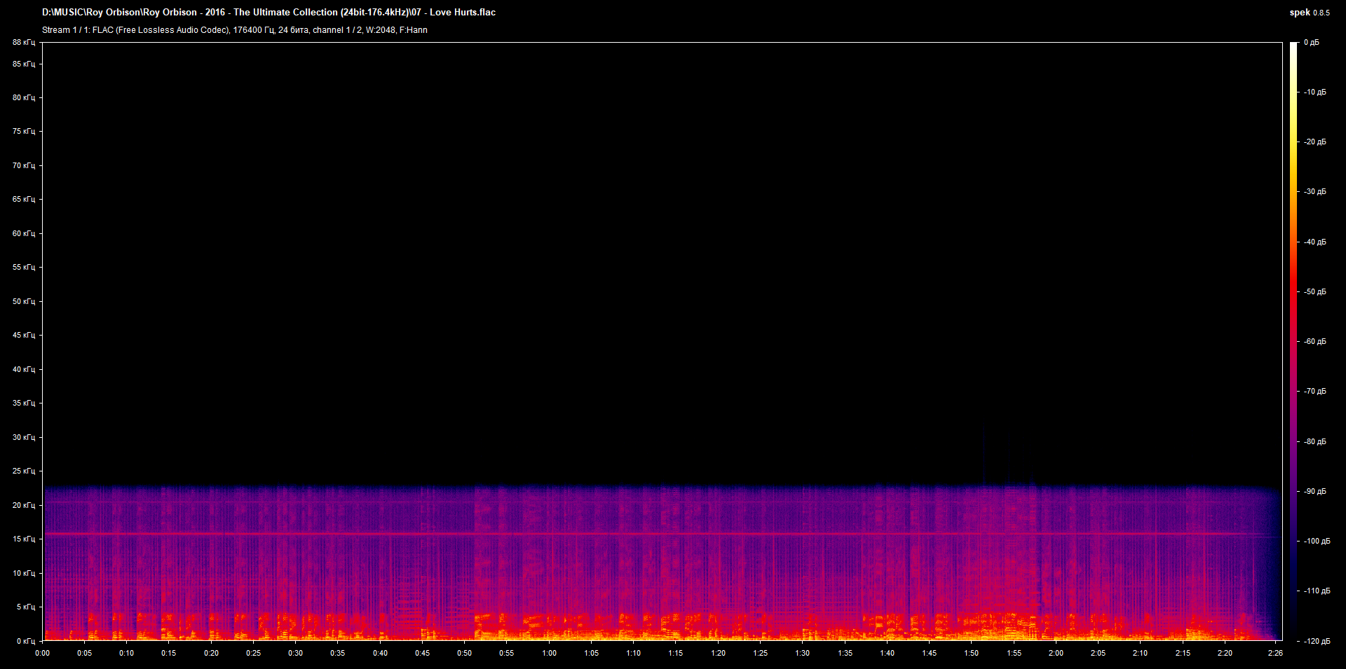 07 - Love Hurts.flac.png