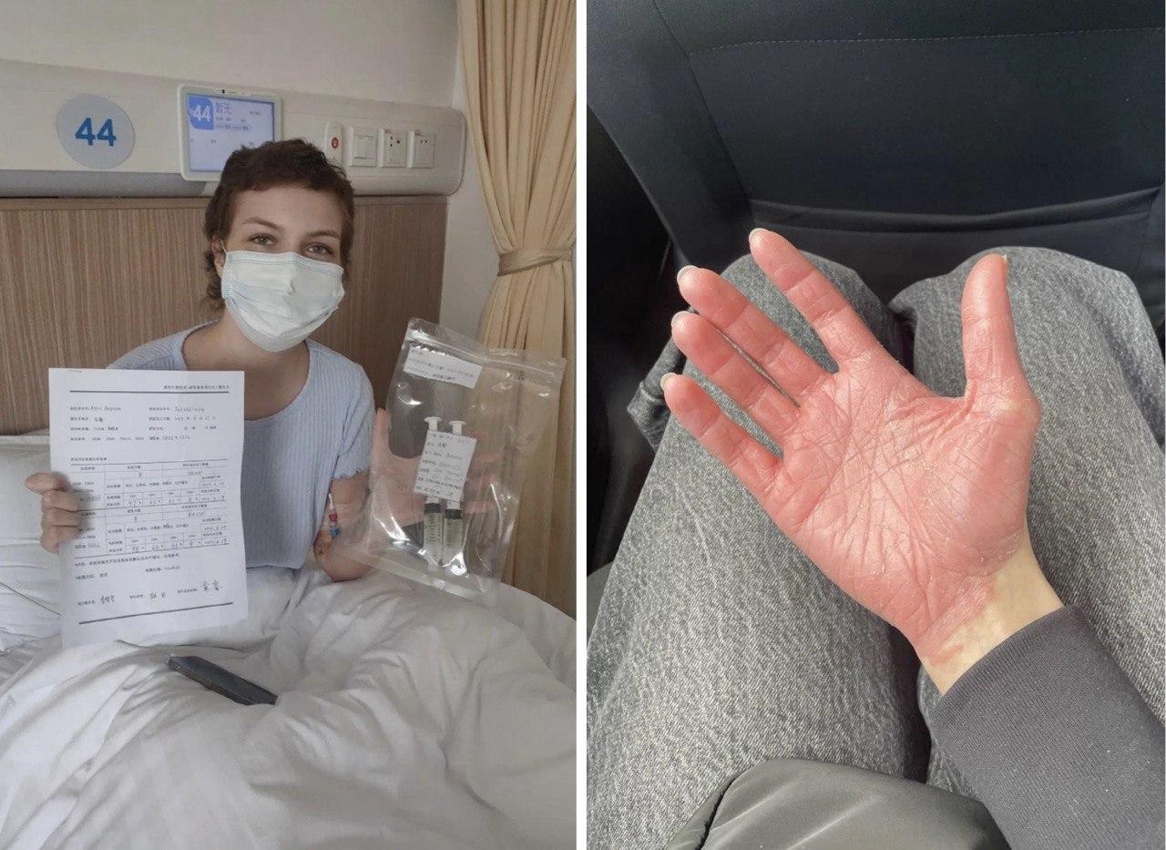 23-летняя медсестра победила рак крови и вышла на работу в онкодиспансер